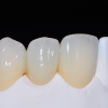 China  denture processing 义齿
